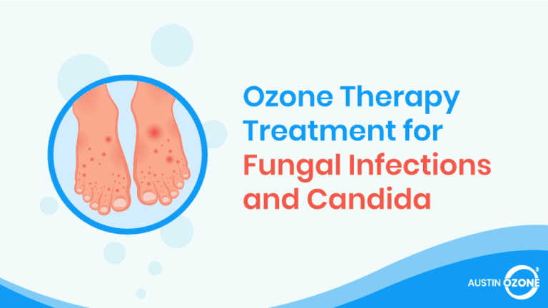 Ozone Therapy Treatment For Fungal Infections And Candida