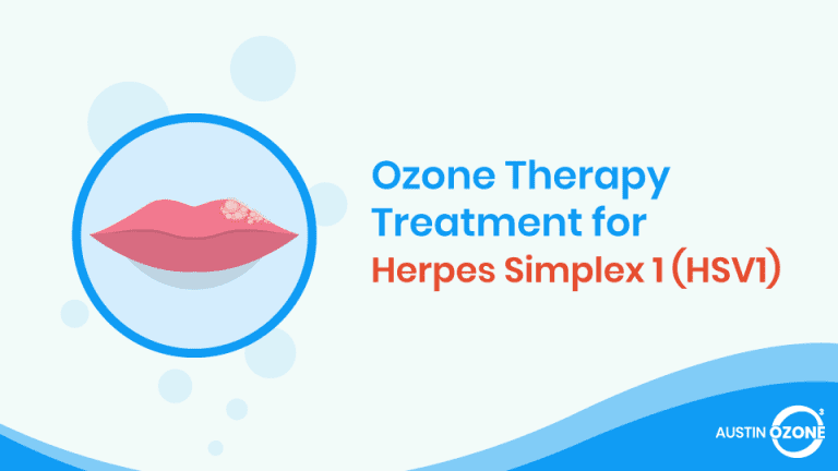 Ozone-Therapy-Treatment-For-Herpes-Simplex-1-Hsv1