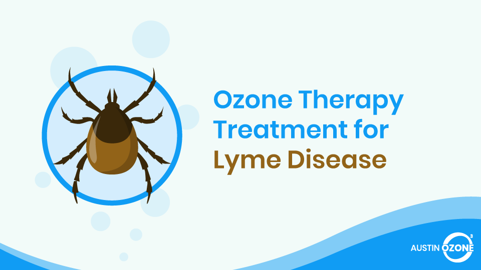 Ozone Therapy for Lyme Disease | Benefits of Ozone Therapy