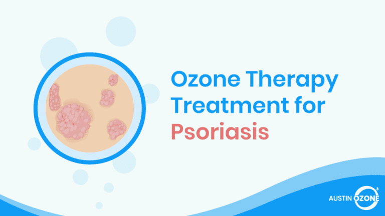 Ozone Therapy For Psoriasis