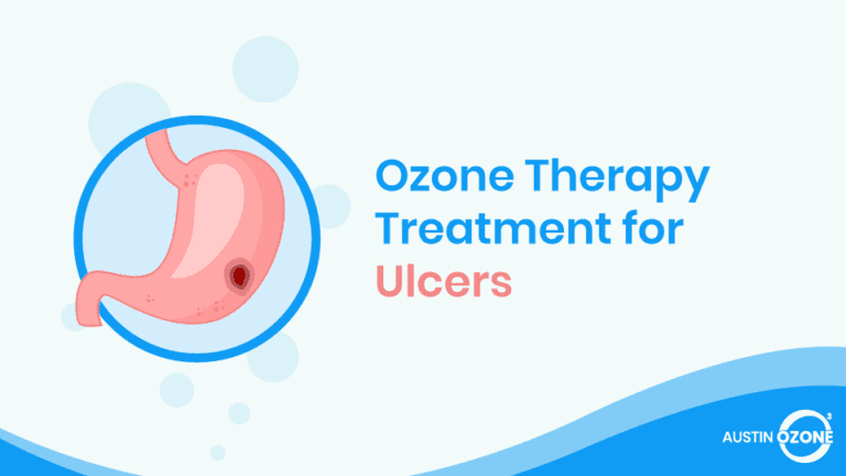 Ozone Therapy Treatment For Diabetic Foot Ulcers