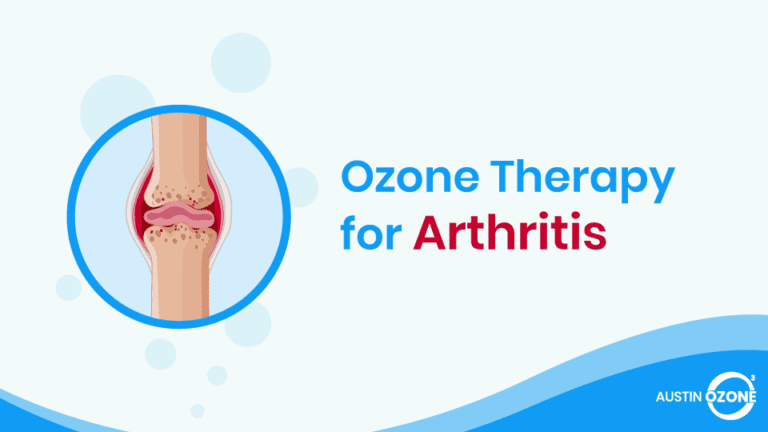 Ozone Therapy For Rheumatoid Arthritis
