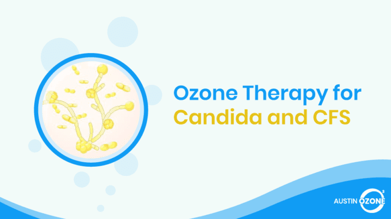 Ozone Therapy for Candida and CFS