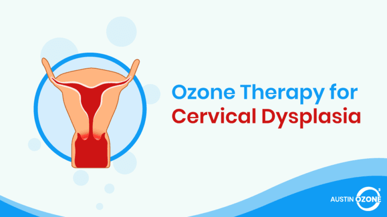 Ozone Therapy for Cervical Dysplasia