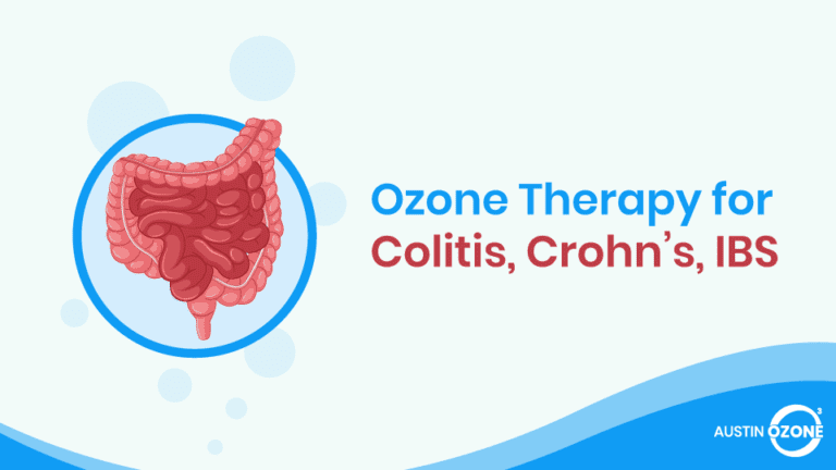 Ozone Therapy for Colitis